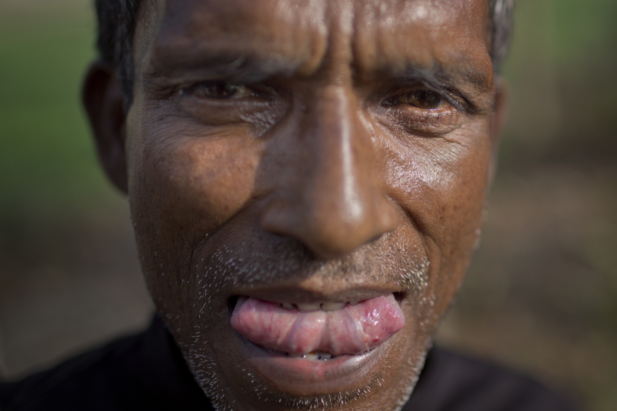 A man who collects date palm sap most days each winter near his home in Faridpur submits to a field medical exam by ICDDR,B’s Arifa Nazneen and Hossain M. S. Sazzad. Photography by A.M. Ahad.
