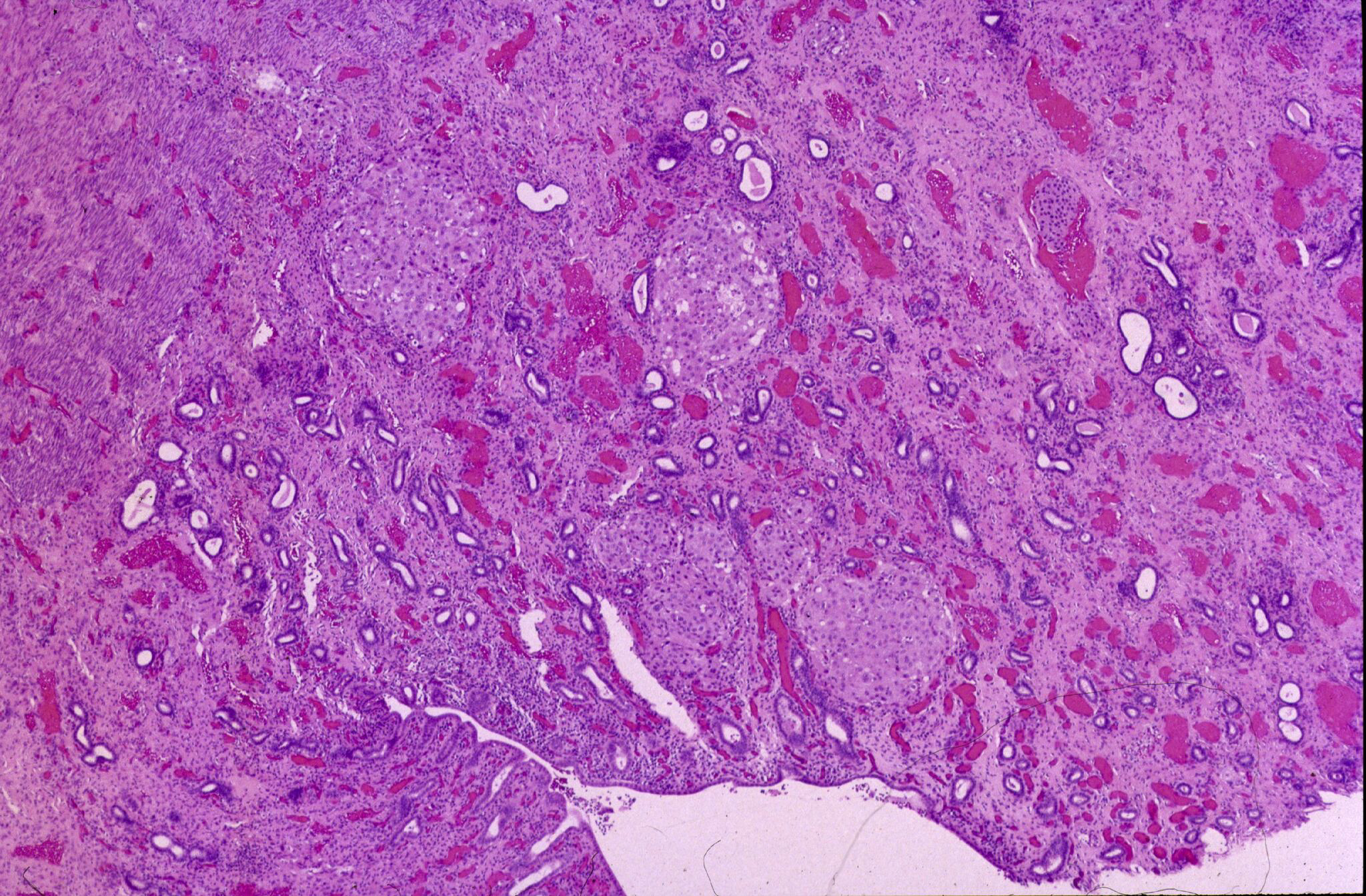 A microscopic image of diseased tissue from a sea lion with cancer. Photo courtesy of The Marine Mammal Center