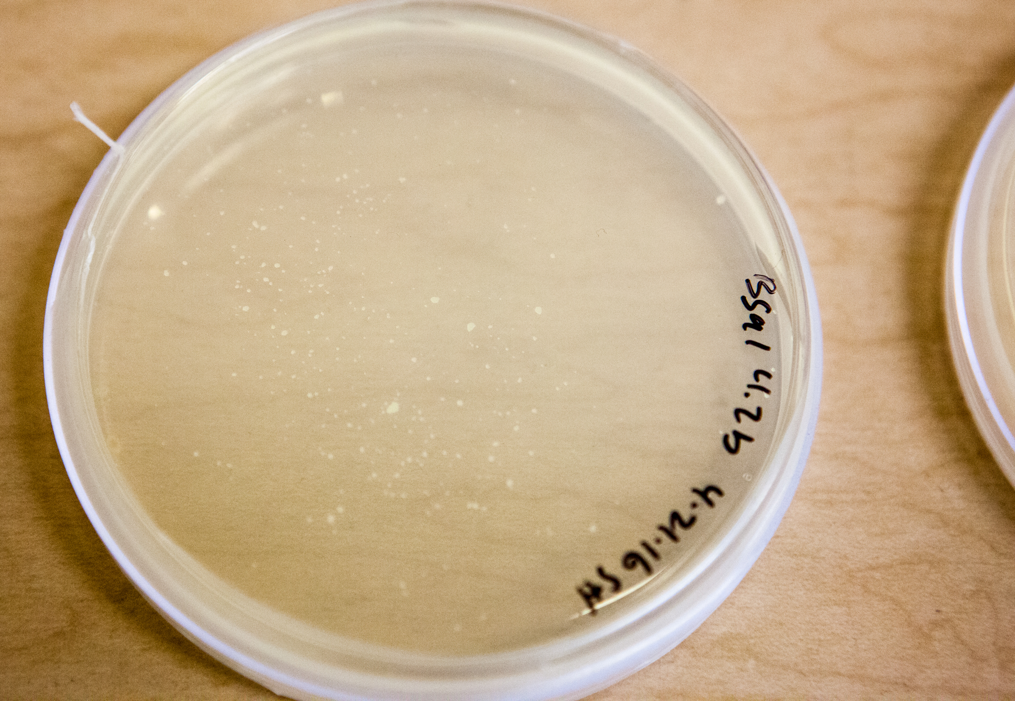 These pale specks on an agar plate may not look like much, but they’re colonies of Bsal, and represent a grave threat to America’s extensive salamander biodiversity. Vredenburg is growing them to use for susceptibility trials in his lab. Photograph by Geoffrey Giller