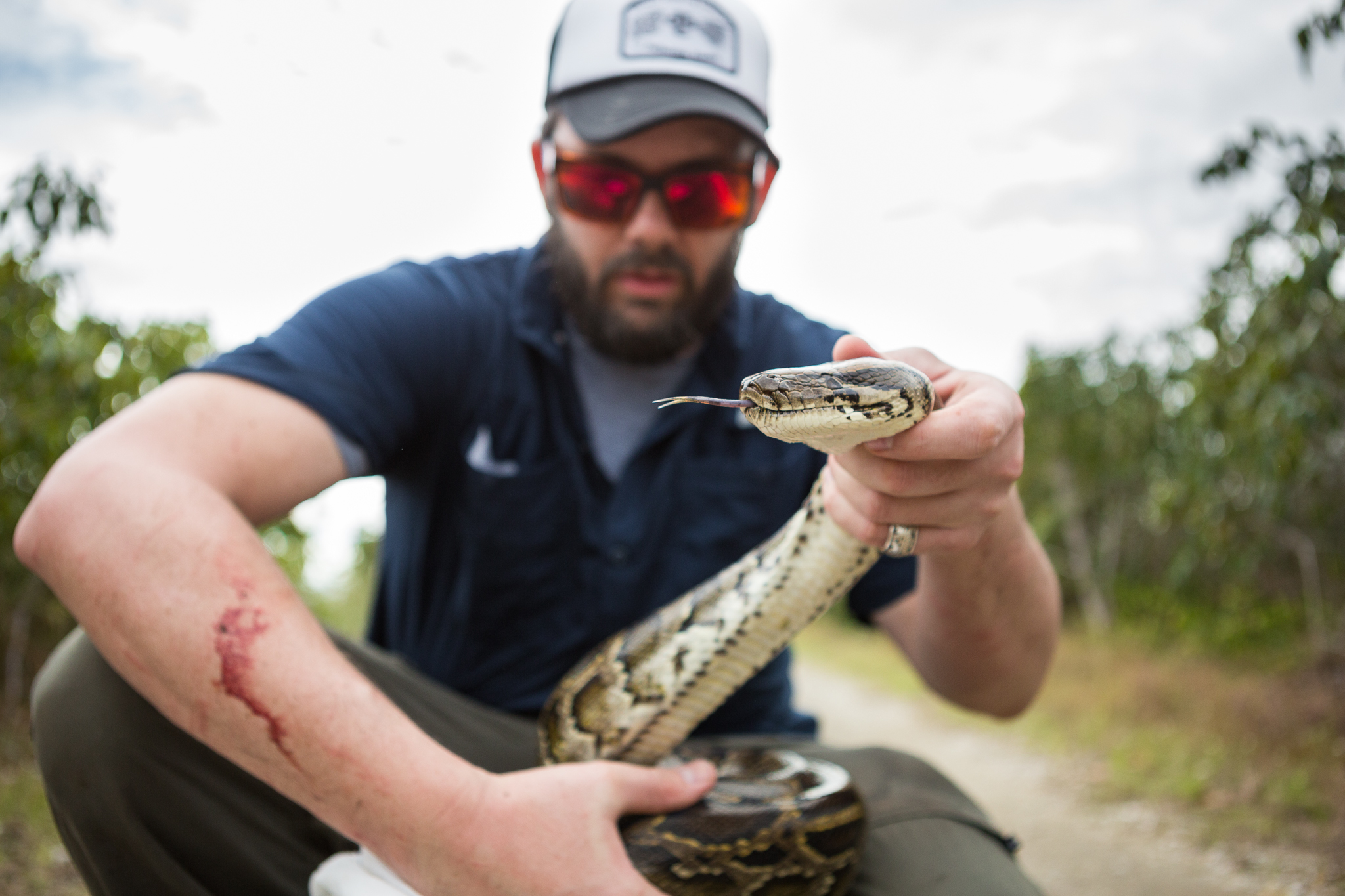 Sean Sterrett bleeds from a bite wound he sustained shortly after capturing this 10-foot-long Burmese python.