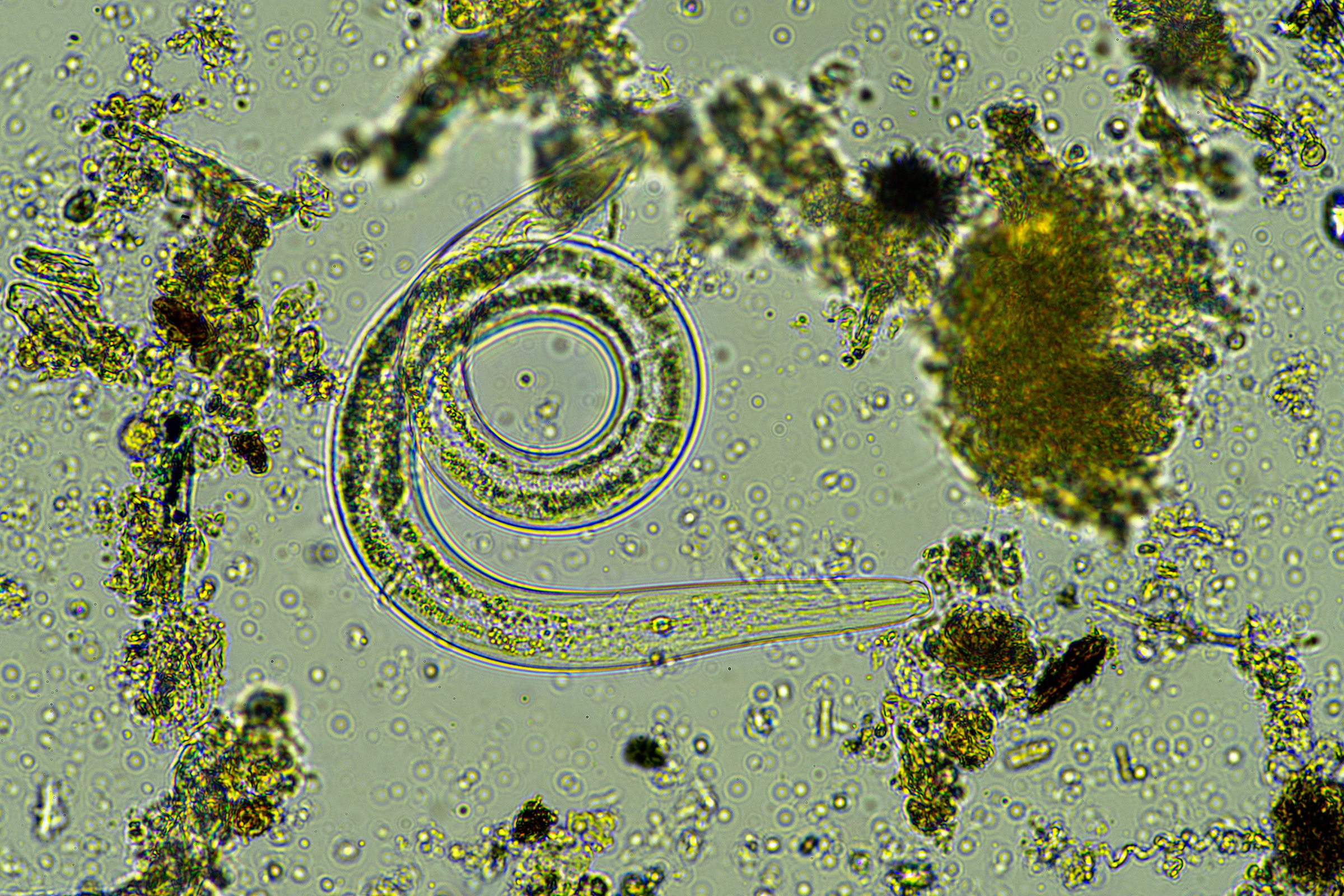 Microorganisms, such as the wormlike nematode seen here, exist in all of Earth’s soils and facilitate the decay process. Photograph by William Edge / Shutterstock